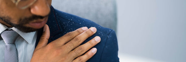 The Lowdown On Dandruff y Cómo estar sin escamas
